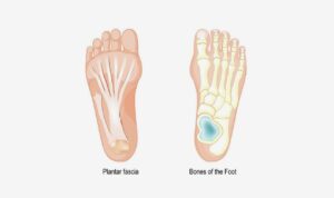 Plantar Fascia and bones of the foot