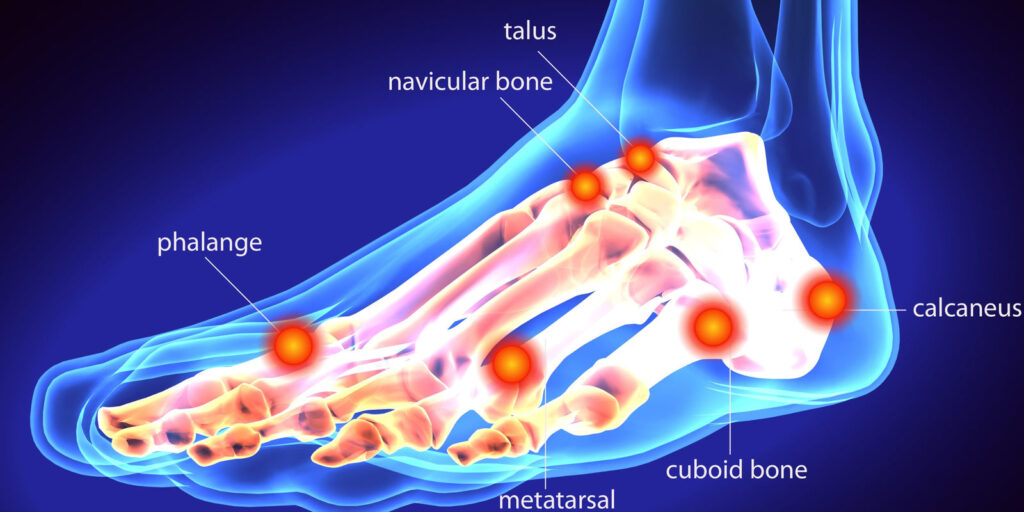 Bursitis