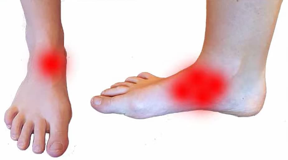 Two feet with red highlighted areas indicating pain points