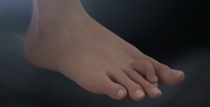 A close-up of a human foot against a dark background